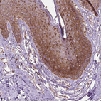 Anti-NLRX1 Antibody