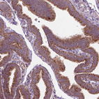 Immunohistochemical staining of human fallopian tube shows strong cytoplasmic granular positivity in glandular cells.