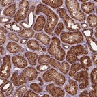 Immunohistochemical staining of human kidney shows strong cytoplasmic granular positivity in cells in tubules.