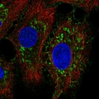 Immunofluorescent staining of human cell line A549 shows localization to plasma membrane & mitochondria.