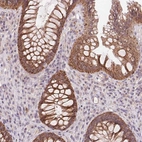 Anti-RANBP3L Antibody