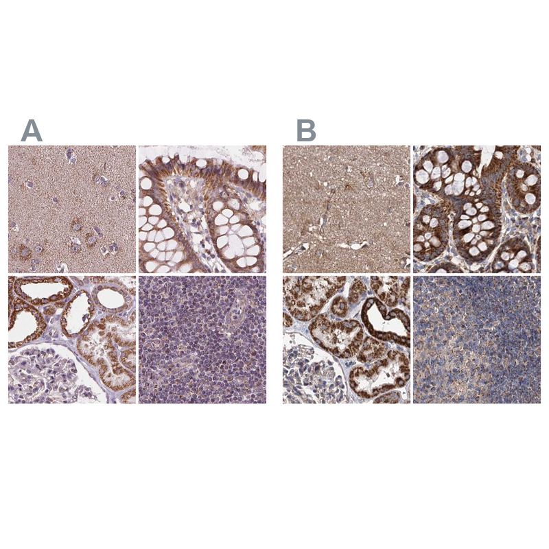 Anti-SUCLA2 Antibody