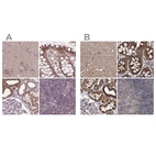 Anti-SUCLA2 Antibody