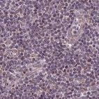 Immunohistochemical staining of human lymph node using Anti-SUCLA2 antibody HPA061528.