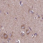 Immunohistochemical staining of human cerebral cortex using Anti-SUCLA2 antibody HPA061528.