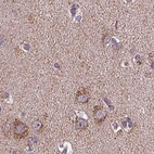 Immunohistochemical staining of human cerebral cortex using Anti-SUCLA2 antibody HPA061528.