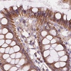 Immunohistochemical staining of human colon using Anti-SUCLA2 antibody HPA061528.