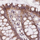 Immunohistochemical staining of human colon using Anti-SUCLA2 antibody HPA061528.