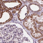 Anti-SUCLA2 Antibody