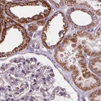 Immunohistochemical staining of human kidney using Anti-SUCLA2 antibody HPA061528.