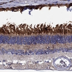 Anti-BCO2 Antibody