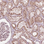 Immunohistochemical staining of human kidney shows strong cytoplasmic positivity in cells in tubules.