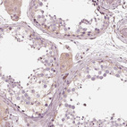 Immunohistochemical staining of human testis shows moderate cytoplasmic positivity in Leydig cells.
