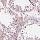 Immunohistochemical staining of human testis shows moderate cytoplasmic positivity in Leydig cells.