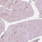Immunohistochemical staining of human skeletal muscle shows no positivity in myocytes as expected.