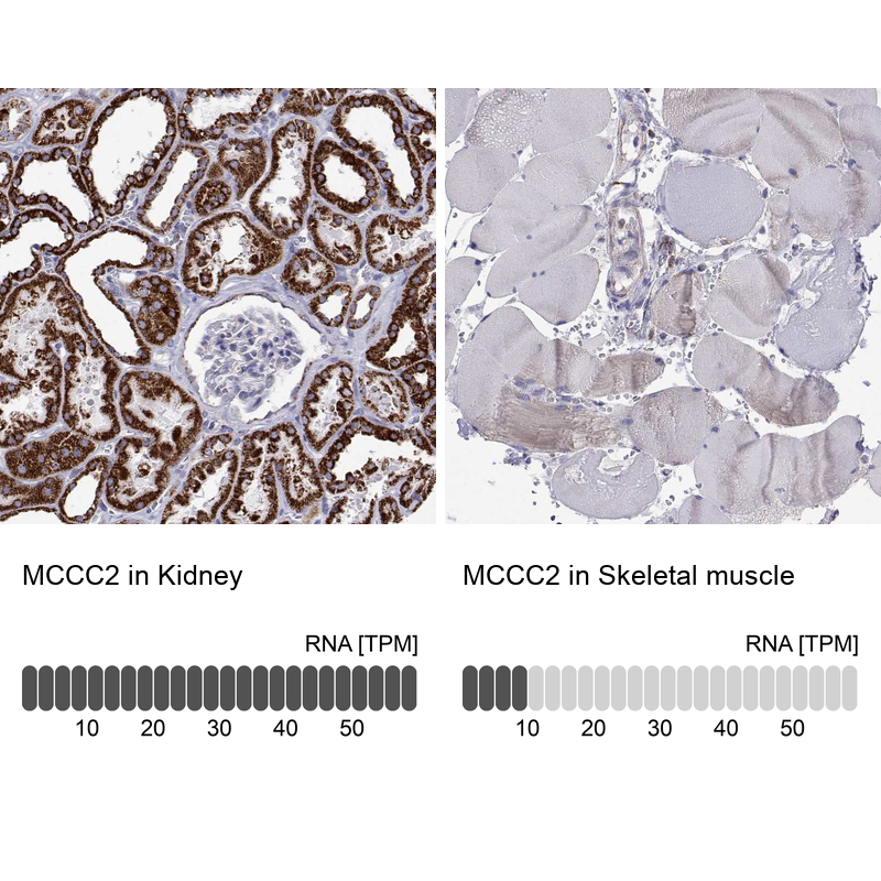 Anti-MCCC2 Antibody