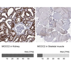 Anti-MCCC2 Antibody