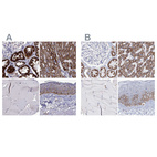 Immunohistochemical staining of human kidney, liver, skeletal muscle and skin using Anti-MCCC2 antibody HPA061546 (A) shows similar protein distribution across tissues to independent antibody HPA038300 (B).