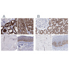 Anti-MCCC2 Antibody