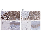 Immunohistochemical staining of human kidney, liver, skeletal muscle and skin using Anti-MCCC2 antibody HPA061546 (A) shows similar protein distribution across tissues to independent antibody HPA038300 (B).