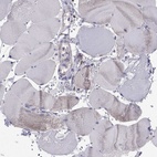 Anti-MCCC2 Antibody