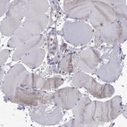 Immunohistochemical staining of human skeletal muscle shows low expression as expected.