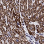 Immunohistochemical staining of human liver using Anti-MCCC2 antibody HPA061546.