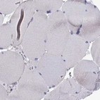 Immunohistochemical staining of human skeletal muscle using Anti-MCCC2 antibody HPA061546.
