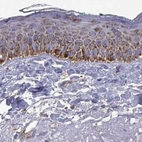 Immunohistochemical staining of human skin using Anti-MCCC2 antibody HPA061546.