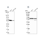 Anti-MCCC2 Antibody