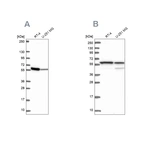 Western blot analysis using Anti-MCCC2 antibody HPA061546 (A) shows similar pattern to independent antibody HPA038301 (B).