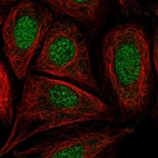 Anti-CCDC61 Antibody