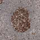 Anti-MSH6 Antibody