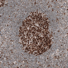 Immunohistochemical staining of human lymph node shows strong nuclear positivity in germinal center cells.