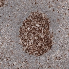 Immunohistochemical staining of human lymph node shows strong nuclear positivity in germinal center cells.