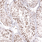 Immunohistochemical staining of human testis shows strong nuclear positivity in cells in seminiferous ducts.