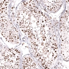 Immunohistochemical staining of human testis shows strong nuclear positivity in cells in seminiferous ducts.