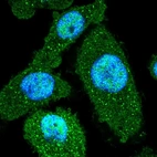 Immunofluorescent staining of human cell line PC-3 shows localization to nucleoplasm, cytosol & vesicles.