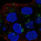 Anti-LTBR Antibody