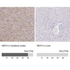 Anti-NEFH Antibody