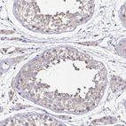 Immunohistochemical staining of human testis shows weak cytoplasmic positivity in cells in seminiferous ducts.