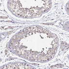 Anti-NEFH Antibody