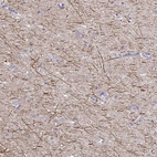 Immunohistochemical staining of human cerebral cortex shows strong membranous positivity in neuropil.