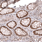 Immunohistochemical staining of human colon shows strong nuclear positivity in glandular cells.
