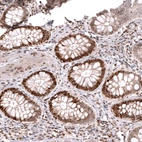 Immunohistochemical staining of human colon shows strong nuclear positivity in glandular cells.