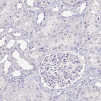 Anti-NEFH Antibody