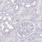 Immunohistochemical staining of human kidney shows no positivity as expected.