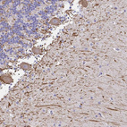 Anti-NEFH Antibody