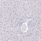 Immunohistochemical staining of human liver shows no positivity as expected.