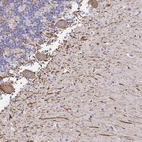 Immunohistochemical staining of human cerebellum shows strong cytoplasmic positivity in Purkinje cells.